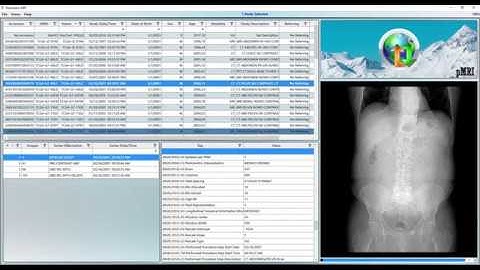 pMRI - How to Import and View DICOM images