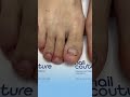 Как восстановить ногти на ногах