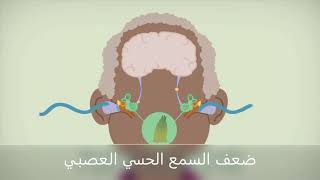 Type of hearing loss👂|انواع ضعف السمع 👂