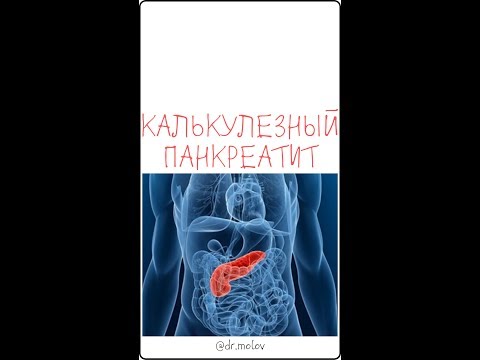 Калькулезный панкреатит