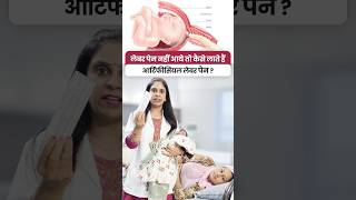 लेबर पेंस नहीं आये तो बच्चेदानी का मुँह  ऐसे खोलते हैं?(Induction of labour) #ytshorts #labour screenshot 1