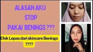 BERHENTI PAKAI BENINGS SKINCARE SETELAH 8 BULAN