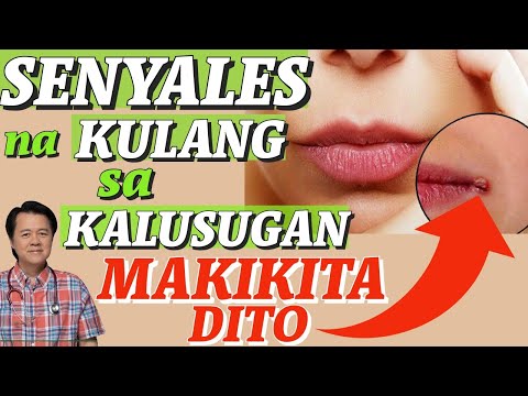 10 Senyales Kulang Ka sa Kalusugan - Payo ni Doc Willie Ong