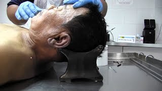 how extreme embalming is done