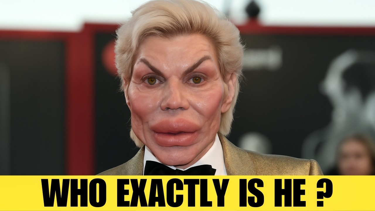 Он был известным актером до пластической операции, угадайте, кем? | Тогда и сейчас, 2026 год