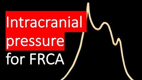 Intracranial pressure (ICP) explained, waveforms and methods