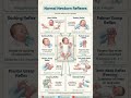 normal newborn reflex #nursing#education #usnurse #nurse #health #healthcare #health #nurses