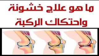 ما هو علاج خشونة واحتكاك الركبة