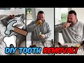 How dads avoid the dentist