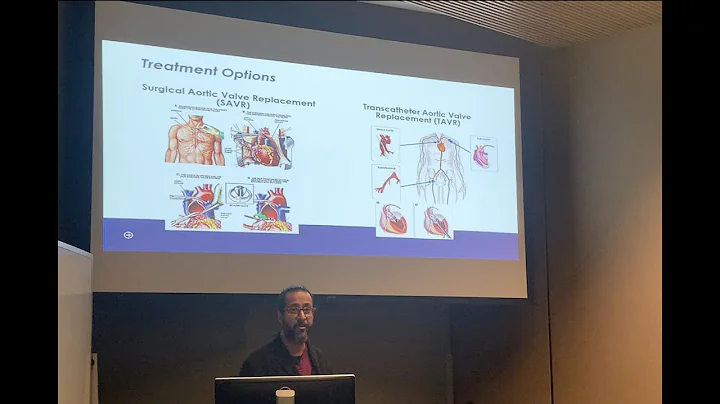 Aortic Valvuloplasty and TAVR:  Some Dos and Donts...