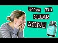 Breaking out much how to clear acne