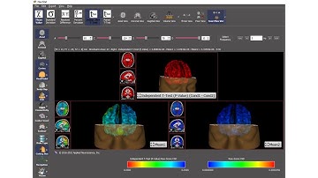 Navistat Introduction - EEG NeuroImaging Statistics