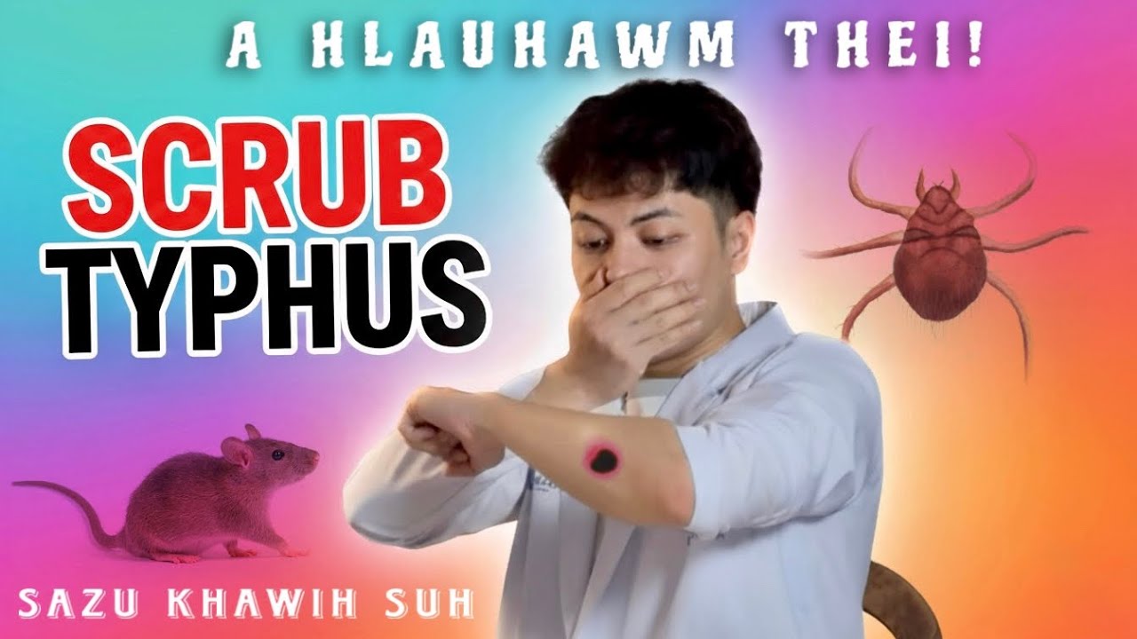 ТИП СЫПА — РАСПРОСТРАНЕННОЕ ЗАБОЛЕВАНИЕ.