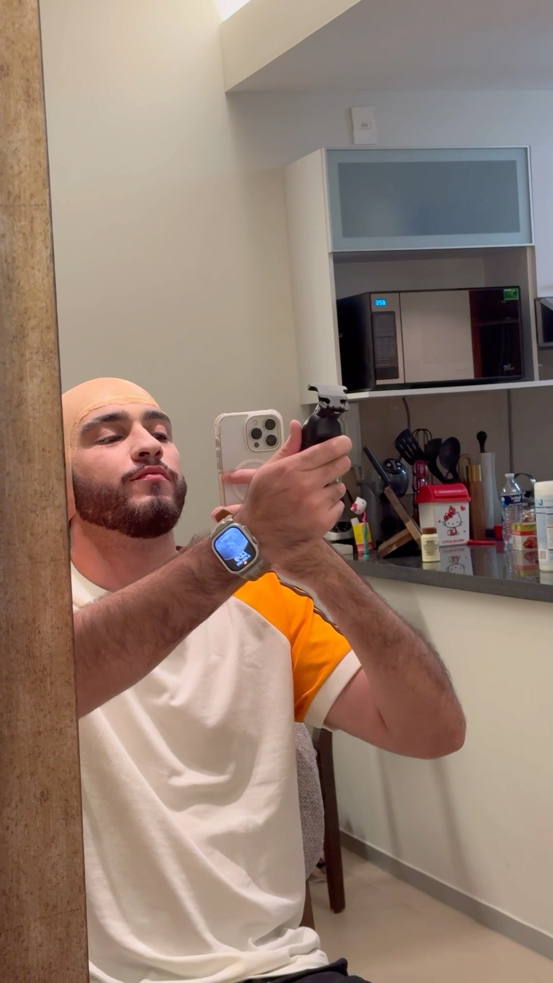 ASÍ SE VE SIN CABELLO ??