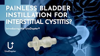 Painless Bladder Instillation for Interstitial Cystitis? Introducing the UroDapter®