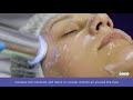 21 non invasive carboxy therapy machine beauty equipment by alvi prague