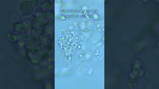 I got coronavirus and put snot under microscope! #everyday #microscopy #foryou #shorts
