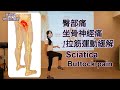 臀部痛、坐骨神經痛的緩解拉筋運動 / 琵塔琪 物理治療師 / 教學直播