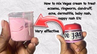 How to mix Vegas cream for skin infection- very effective.