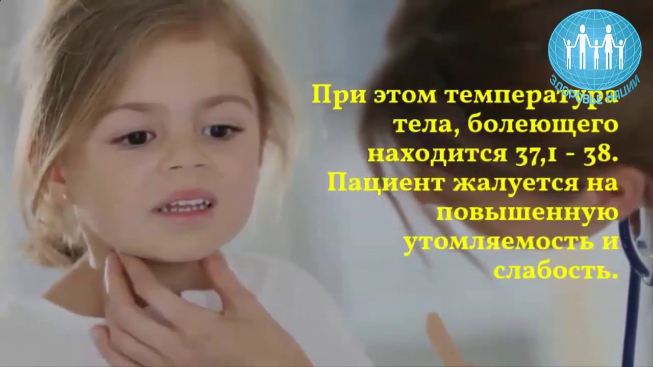 ЗДОРОВЬЕ НАЦИИ тонзиллит симптомы. Как избавиться от тонзиллита - YouTube