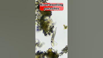 Rotifer: The Microscopic Vacuum Cleaner!   #biology #microscope #nature