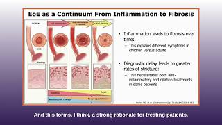 The EoE Playbook: Clues, Criteria, and Clinical Confirmation