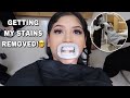 COME WITH ME TO THE DENTIST!!! ANOTHER LIT BRACES VLOG!