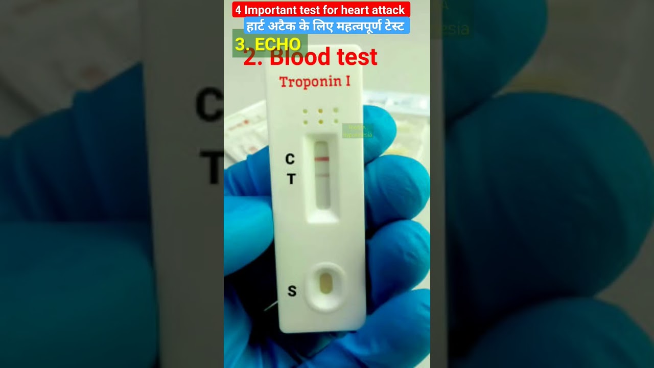 4 Test to diagnose Heart attack💔 l हार्ट अटैक के लिए महत्वपूर्ण टेस्ट 