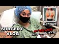 Removing My Breast Implants (SURGERY VLOG) PART 1