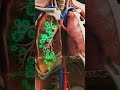Orthohantavirus Explained | Deadly Rodent Virus Causes HFRS &amp; HPS in Humans