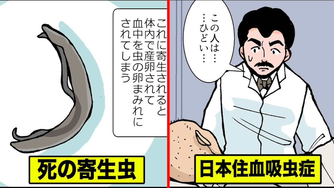 日本 住 血吸虫