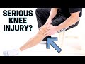 How to Know If You Have a Serious Knee Injury or Problem