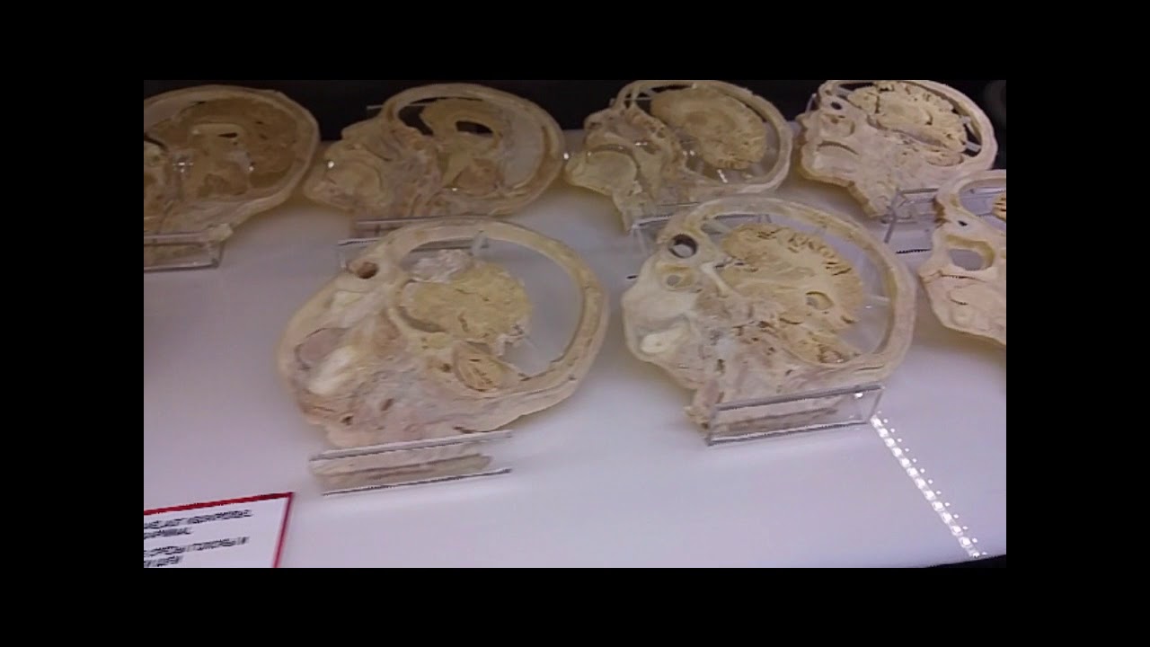 Ahaa Science Center ( Estonya Ahaa Bilim Merkezi ) 6 - YouTube