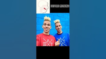 Mewing Transformation 🤫🧏‍♂️ #memes #funny #edit #mewing #mogger #looksmaxxing