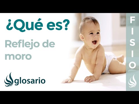 Video: ¿Puede desaparecer el reflejo de sobres alto?