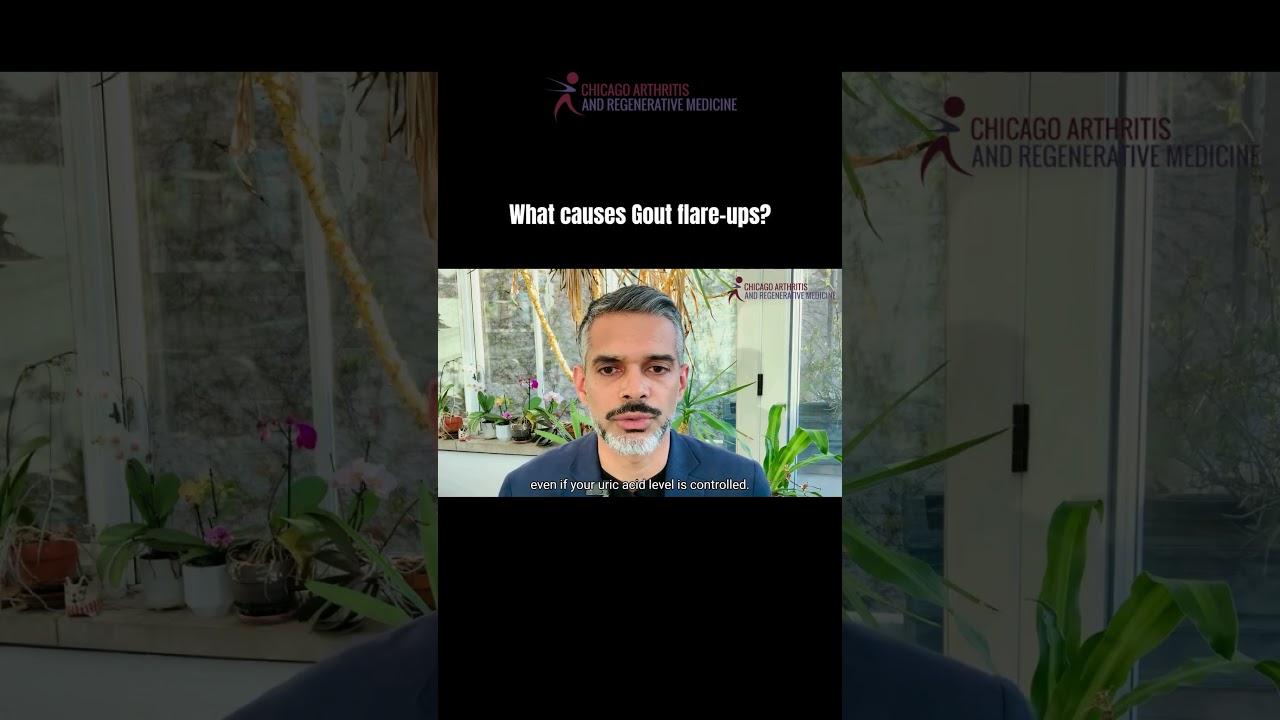 Curious about gout? Watch this video to learn what causes it, and its symptoms. 