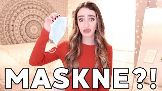 HOW TO PREVENT MASKNE | mask tips you *need* to know