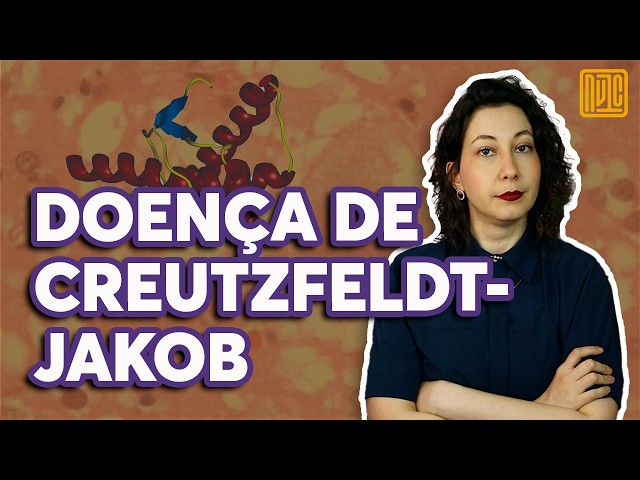 Entenda a doença que atingiu Lito Sousa: o que são príons ?