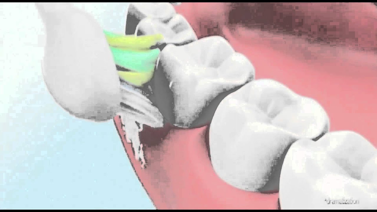 Электрическая звуковая зубная щетка Philips FlexCare PLATINUM HX9182