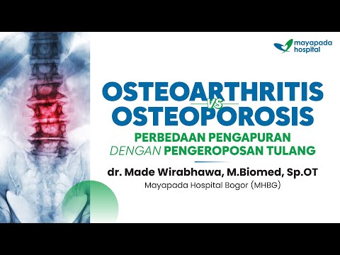 Osteoarthritis, Apakah Pengapuran sama dengan Pengeroposan?