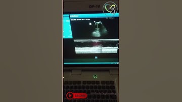 Demo Mindray DP-10 Ultrasound | Hi-Tech Engineering Ly | #hitechEngineeringLy