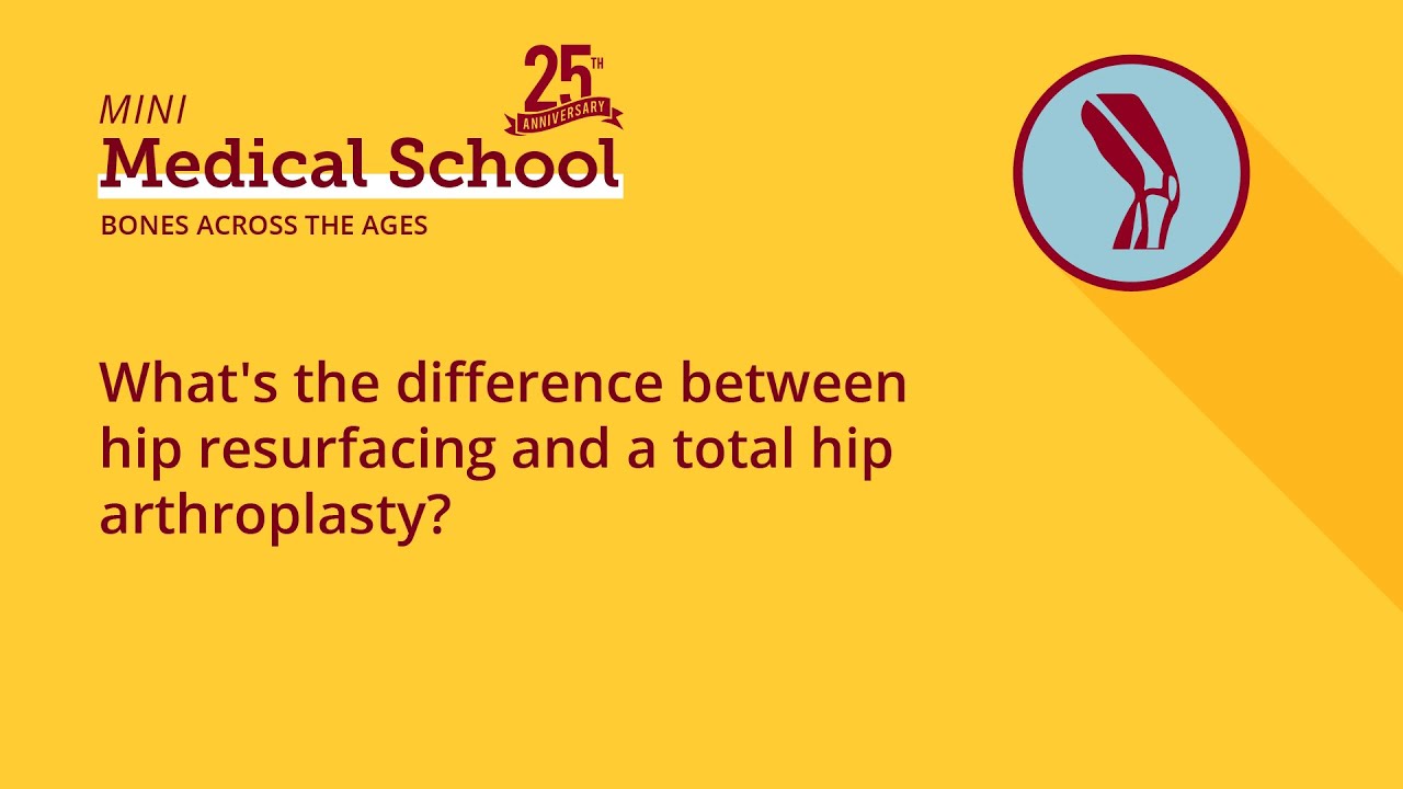 What's the difference between hip resurfacing and a total hip ...