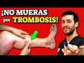 ¡NO MUERAS de TROMBOSIS y COÁGULOS! |GUÍA MÁS COMPLETA de TROMBOSIS VENOSA PROFUNDA