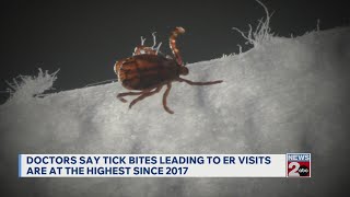 Doctors say tick bites leading to ER trips at highest since 2017