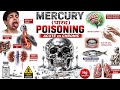 Mercury Toxicity & Minamata Disease | Forensic Toxicology Lecture