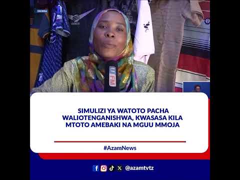 Simulizi Ya Watoto Pacha Waliotenganishwa Kwasasa Kila Mmoja Amebaki Na Mguu Mmoja