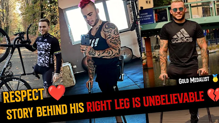 Story Behind His Right Leg is Unbelievable  | Andr...