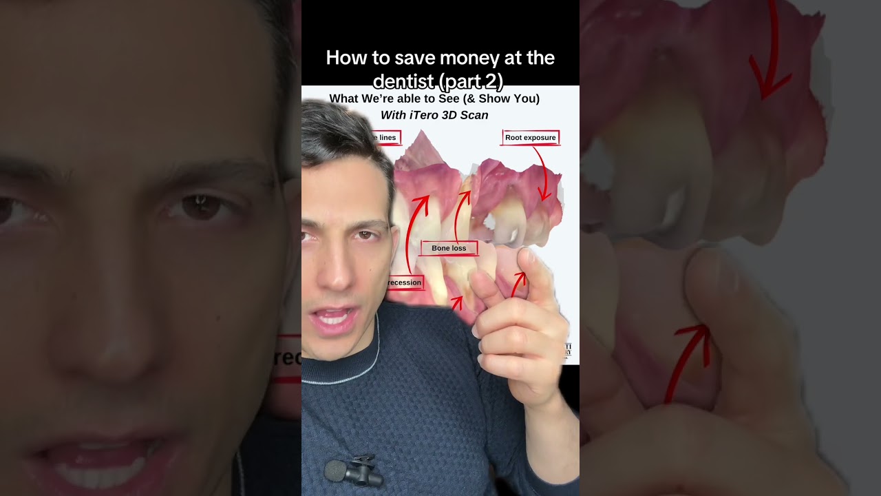 How to save money at the dentist (part 2)