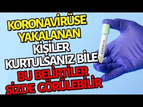 Koronavirüse Yakalanan Her 10 Kişiden 9'unda Bu Belirtiler Var
