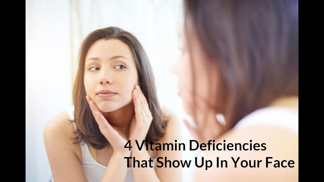 4 Vitamin Deficiencies That Show Up In Your Face YouTube